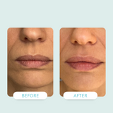 Image of 100 mg NAD+ Lip Renewal Cream